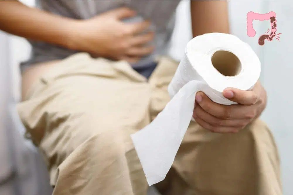 Székrekedés ellen: Életmódbeli tényezők változtatása